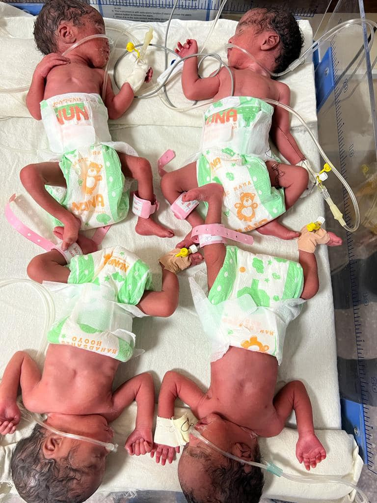 Somali woman gives birth to four babies at once in Mogadishu hospital