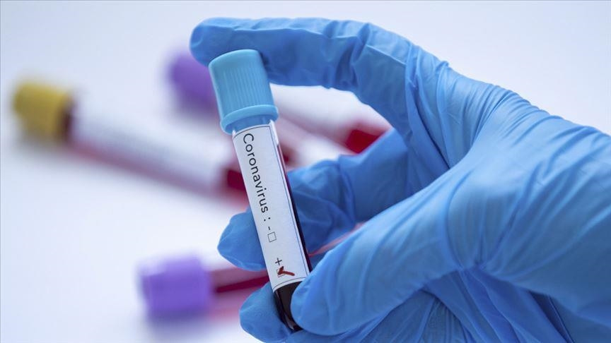 Horn of Africa country reports 9 more deaths, 100 new coronavirus infections